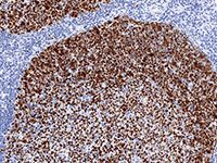 bcl-6 (GI191E/A8) Mouse Monoclonal Antibody