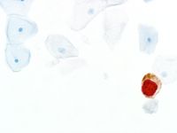 CINtec® PLUS Cytology Kit, CE-IVD