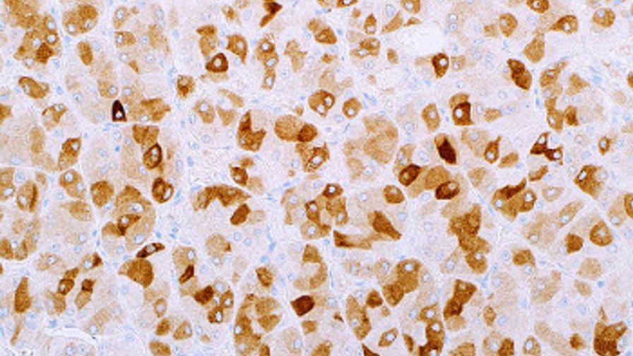 Inhibin, alpha (MRQ-63) Rabbit Monoclonal Antibody