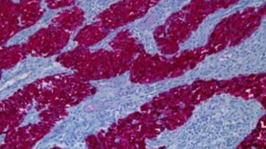 Hmb45 Melanoma Triple Cocktail (HMB45+A103+T311) Primary Antibody