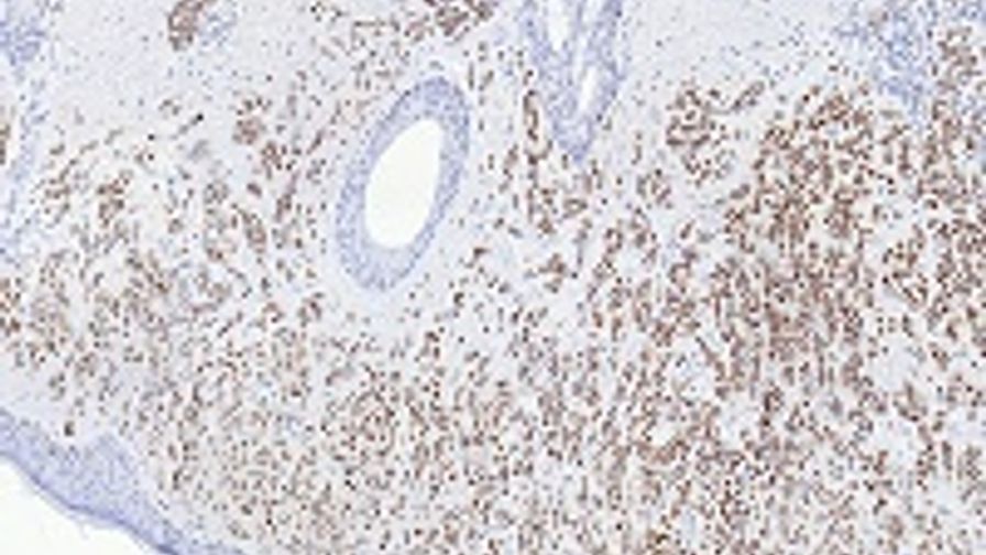SOX-10 (SP267) Rabbit Monoclonal Primary Antibody SOX-10 (SP267) Rabbit Monoclonal Primary Antibody