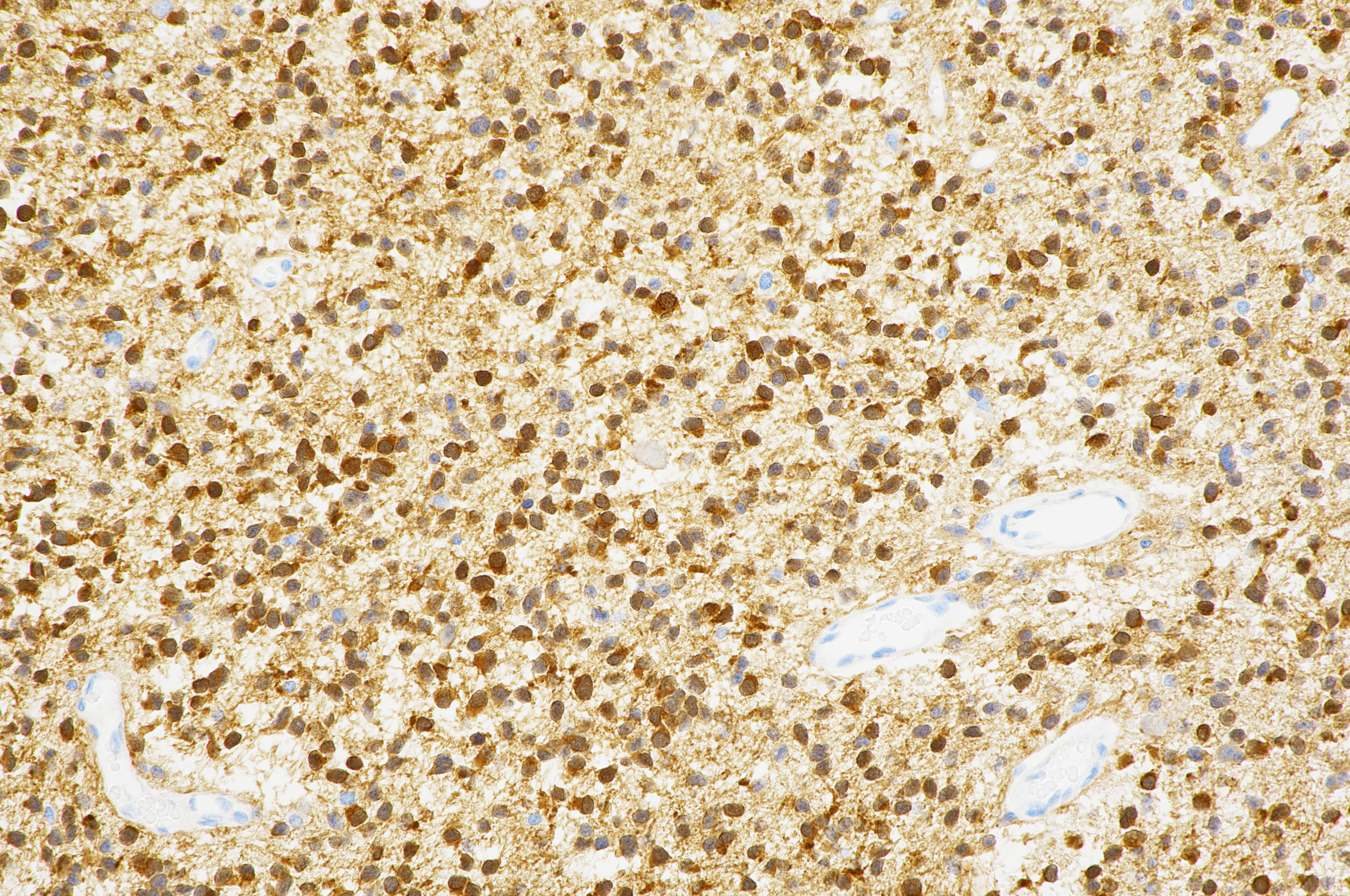 67 Rabbit IDH1 R132H (MRQ-67) Rabbit Monoclonal Antibody