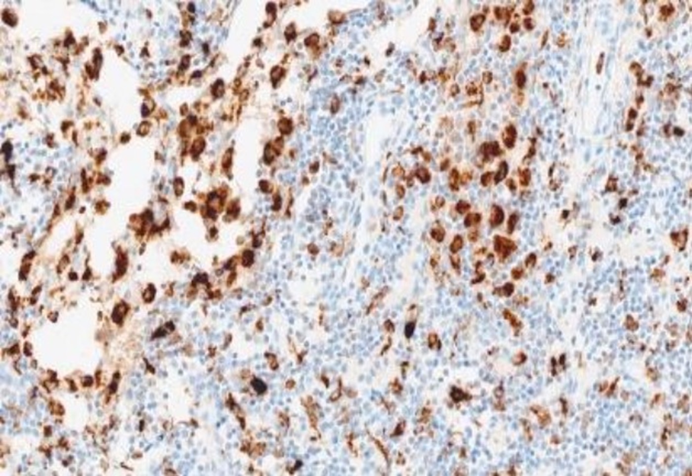 CD68 (SP251v18) Rabbit Monoclonal Antibody