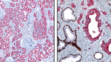 anti-p504s (SP116) Rabbit Monoclonal Primary Antibody