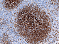 CD21 (2G9) Mouse Monoclonal Antibody CD21 (2G9) Mouse Monoclonal Antibody