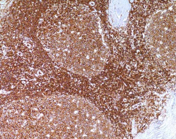 CD45 (LCA) (2B11 & PD7/26) Mouse Monoclonal Antibody