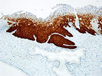 CINtec<sup>®</sup> Histology, US-FDA