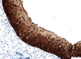 CINtec® p16 Histology, Japan