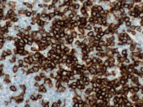 CONFIRM anti-Lambda Rabbit Polyclonal Primary Antibody