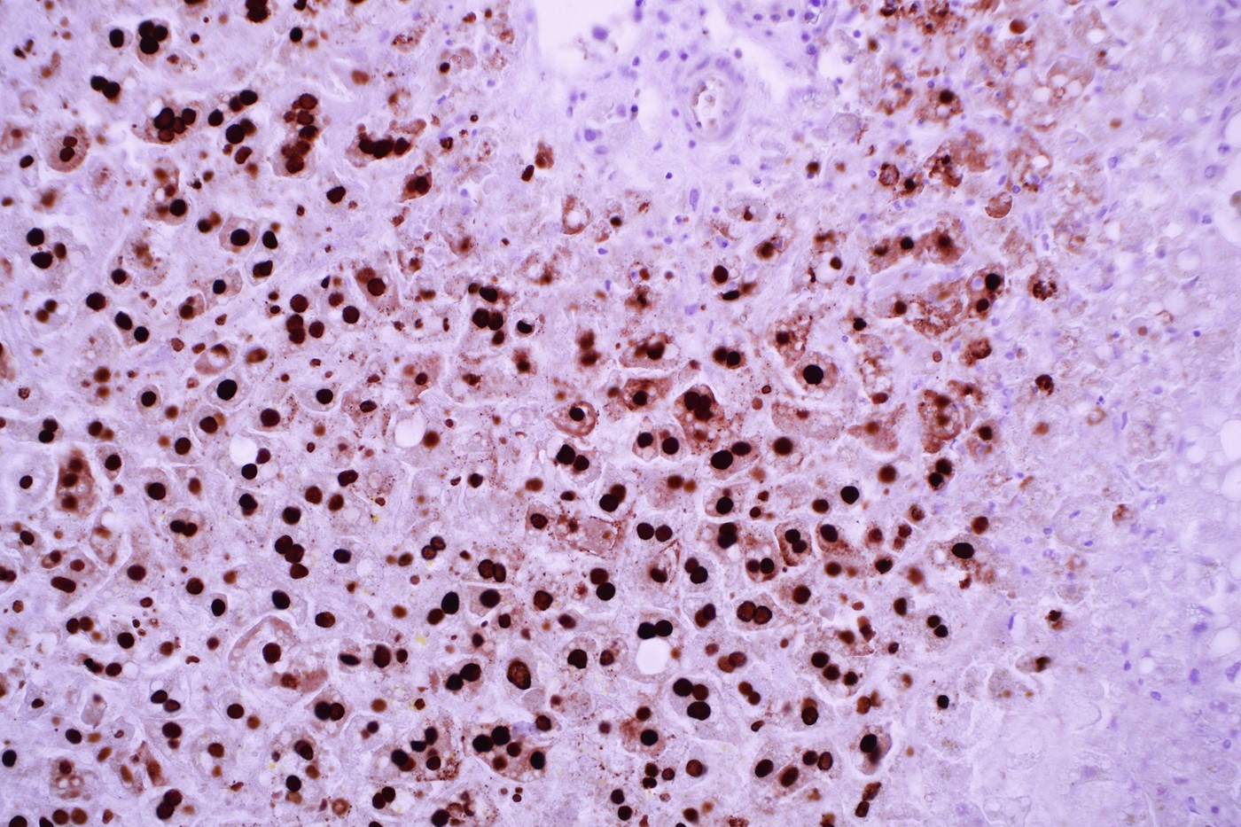 Herpes Simplex Virus 1 (10A3) Mouse Monoclonal Antibody