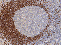 IgD Rabbit Polyclonal Antibody