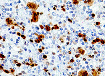 MUM1 (EP190) Rabbit Monoclonal Primary Antibody
