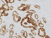 VENTANA<sup>®</sup> anti-ALK (D5F3) Rabbit Monoclonal Primary Antibody, CE-IVD