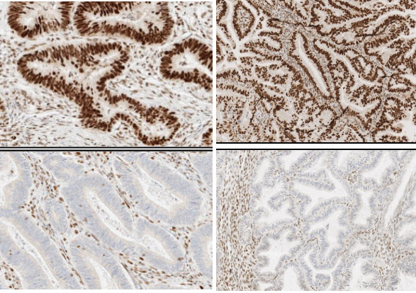VENTANA® anti-MSH2 (G219-1129) Mouse Monoclonal Primary Antibody