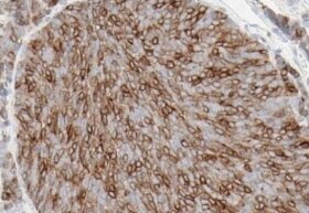 VENTANA® DLL3 (SP347) Assay