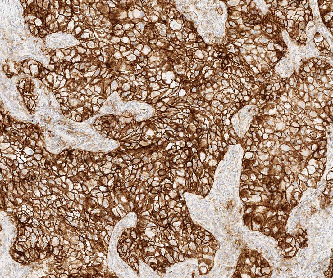 VENTANA<sup>®</sup> PD-L1 (SP263) Rabbit Monoclonal Primary Antibody