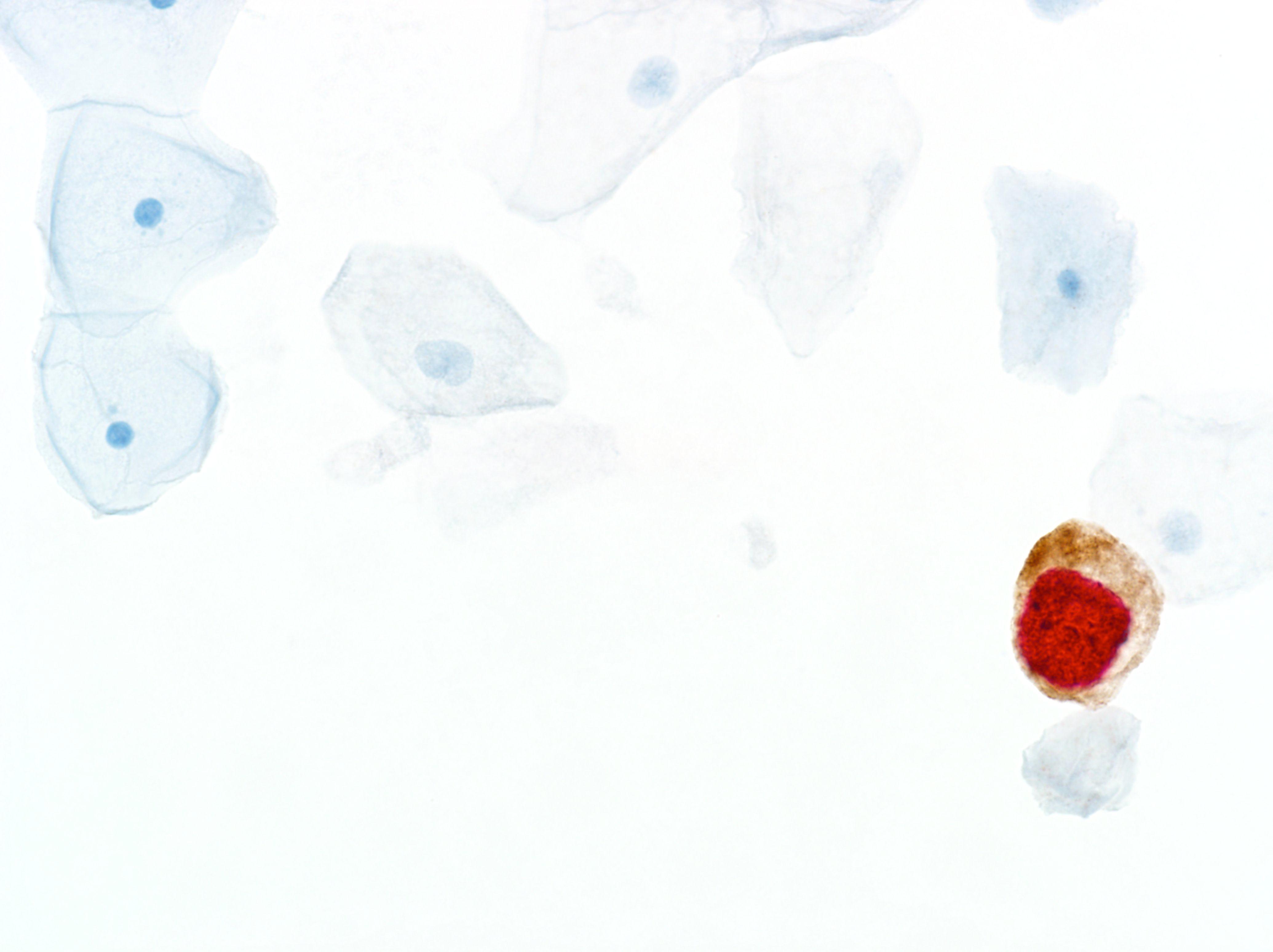CINtec® PLUS Kit, CE-IVD