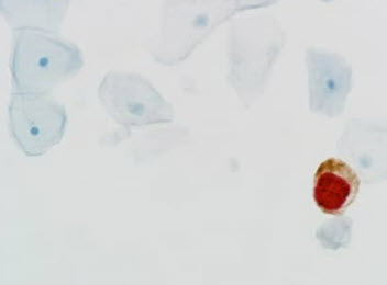 CINtec<sup>®</sup> <i>PLUS</i> Cytology, US-FDA