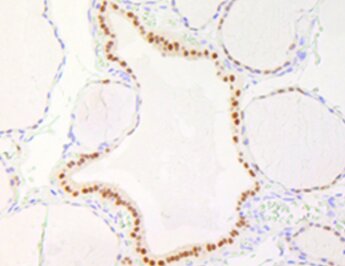 PAX8 (EP331) Rabbit Monoclonal Antibody