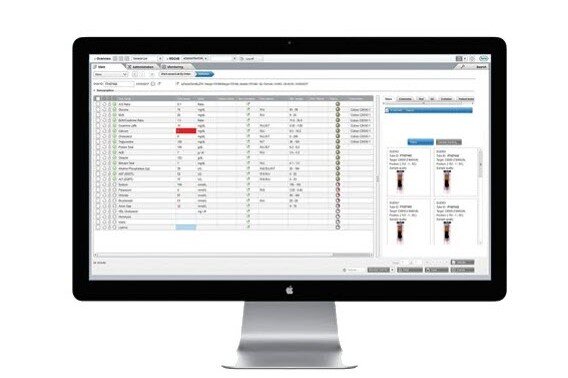 <b>cobas<sup>®</sup> infinity</b> central lab, <b>cobas<sup>®</sup> infinity</b> central lab was designed to allow you to identify, address and solve your lab’s biggest challenges, using a single, easy-to-use solution.