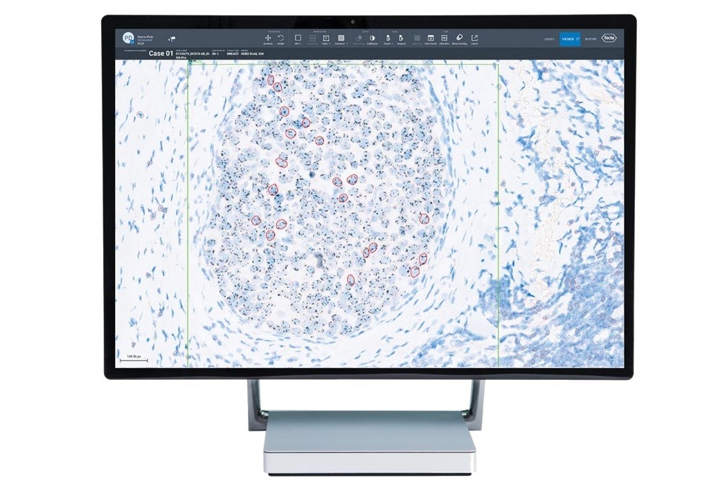 uPath HER2 Dual ISH image analysis, Breast